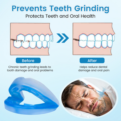LAST DAY SALE 60% OFF⏰PerfectSleep Solution- Anti-Snoring & Anti-Grinding Teeth Protector..