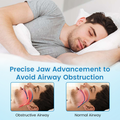 LAST DAY SALE 60% OFF⏰PerfectSleep Solution- Anti-Snoring & Anti-Grinding Teeth Protector..